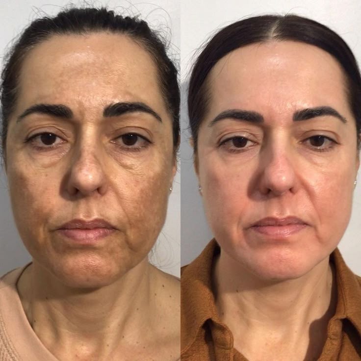 Resultado Beleza Natural